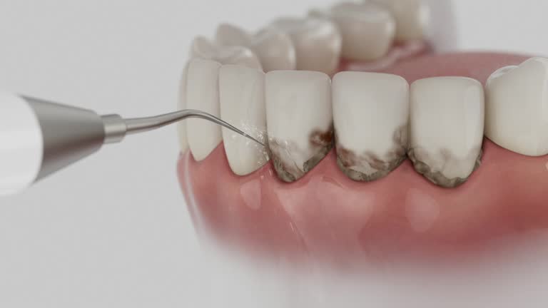 Reliable Dental Implants contractor in Oakley, CA by Smile Center Dentistry